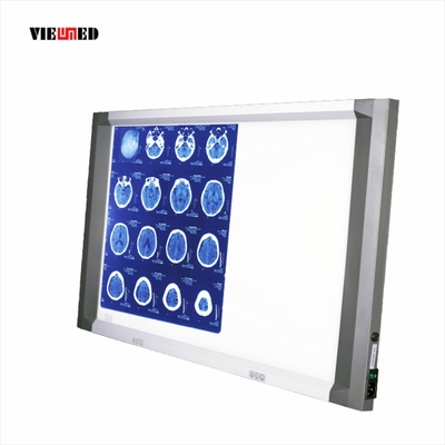 Independent Dimming Freestanding X-Ray Led X-Ray Film Viewer Negatoscope Film Viewer